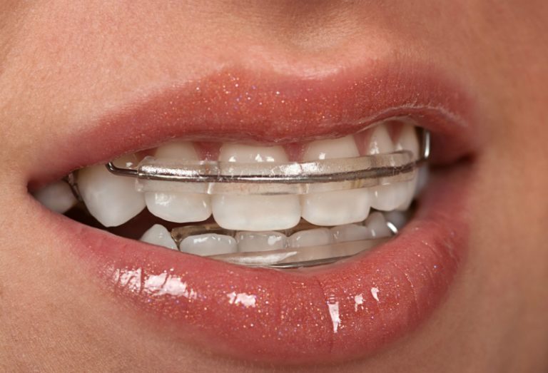 How To Choose The Best Orthodontist In St Augustine