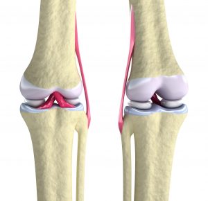 Modern Techniques to Alleviate Knee Pain Without Immediate Knee Replacement in Appleton, WI