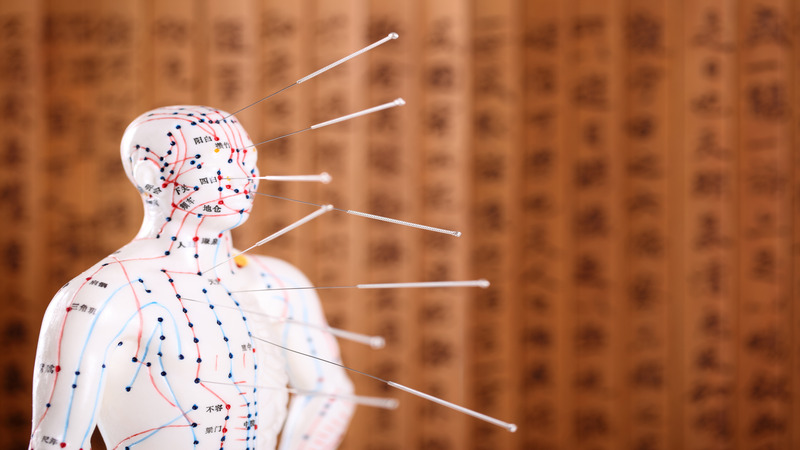 Why Residents Choose Acupuncture Therapy in Bellingham, WA for Natural Pain Solutions