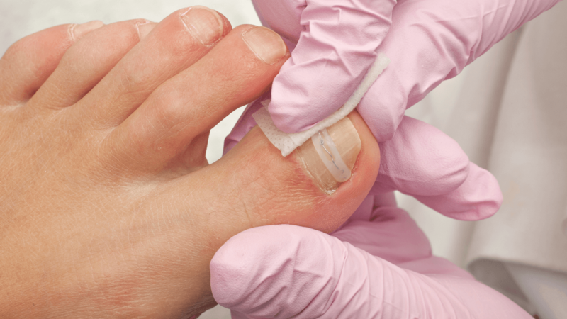 The Athlete’s Guide to Foot and Ankle Health: Preventing and Treating Common Sports Injuries