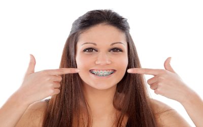Enhance Your Smile with Ceramic Braces In Fort Lauderdale, FL, for a Confident Appearance
