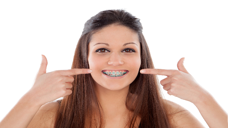 Enhance Your Smile with Ceramic Braces In Fort Lauderdale, FL, for a Confident Appearance