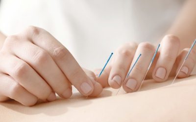 Experience Lasting Relief with Acupuncture For Pain Management In Berkeley, CA Solutions That Work