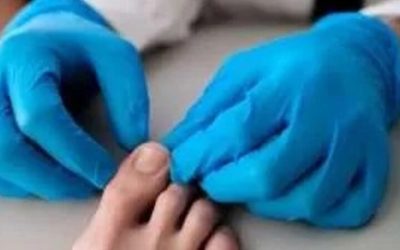 What to Expect When You Visit a Bunion Doctor: Your First Consultation
