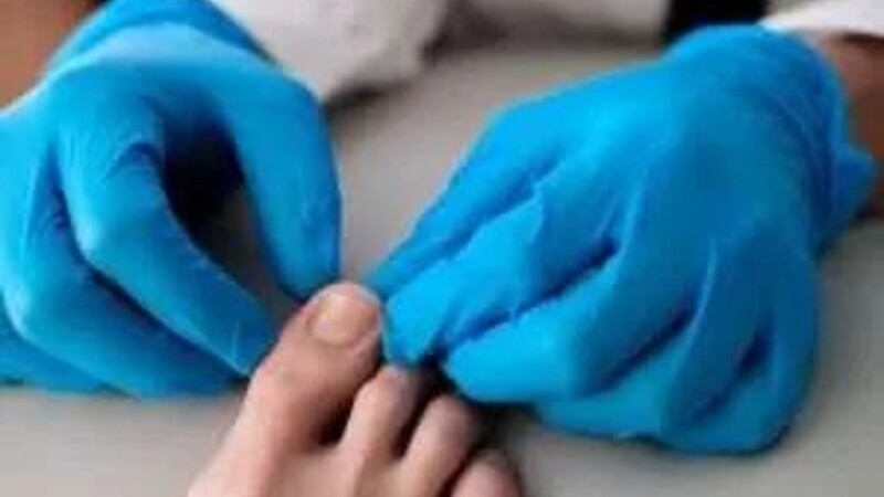What to Expect When You Visit a Bunion Doctor: Your First Consultation