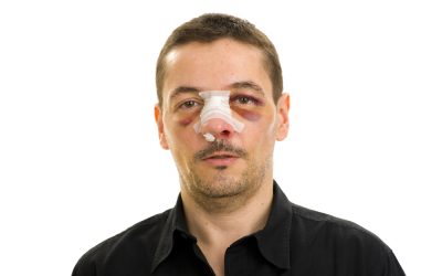 Key Benefits of Choosing a Personal Injury Law Firm in Bamberg, SC for Your Case