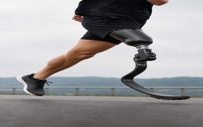Real Stories of Triumph With a Prosthetic Running Leg, Butte County, CA Residents Use