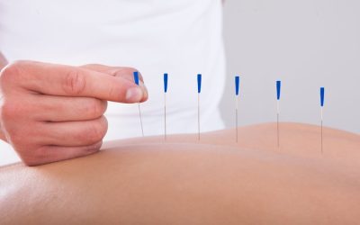 Relieve Chronic Pain Naturally With Acupuncture For Pain Management In Berkeley, CA Residents Trust