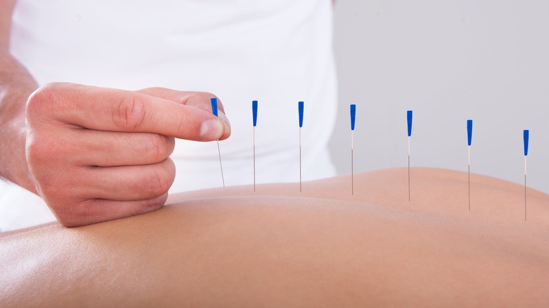 Relieve Chronic Pain Naturally With Acupuncture For Pain Management In Berkeley, CA Residents Trust