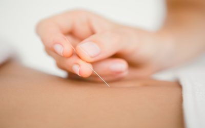 Holistic Reproductive Health Improved by Fertility Acupuncture In Westport, CT Care