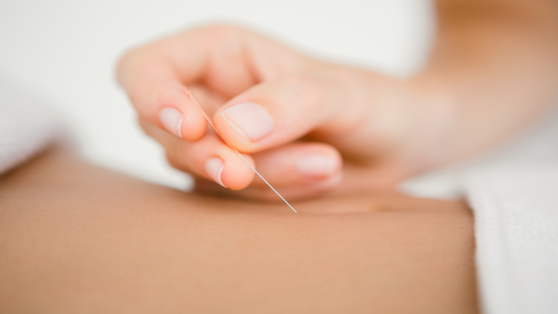 Holistic Reproductive Health Improved by Fertility Acupuncture In Westport, CT Care