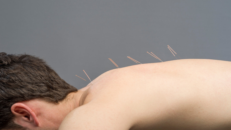 Find Lasting Relief from Stress Using Acupuncture In Sudden Valley, WA, Treatments Near You