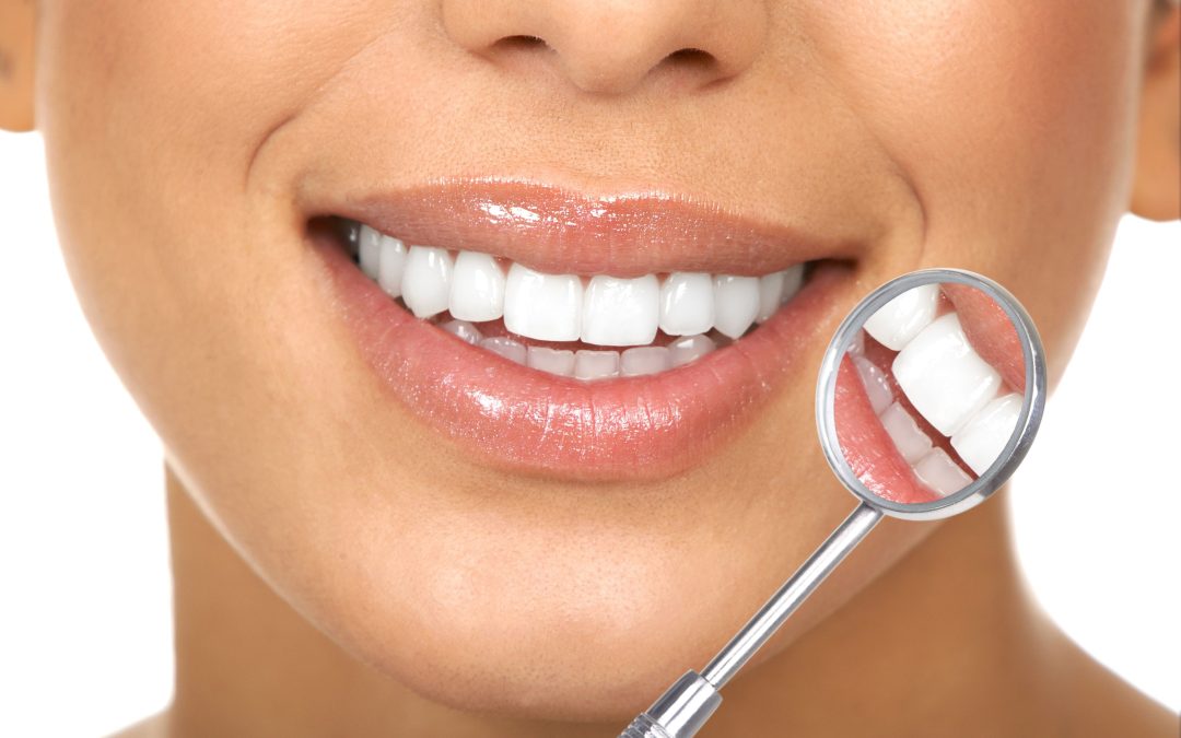 Teeth Whitening Spruce Grove Choices for Long Lasting Results and Minimal Sensitivity