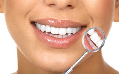 Teeth Whitening Spruce Grove Choices for Long Lasting Results and Minimal Sensitivity