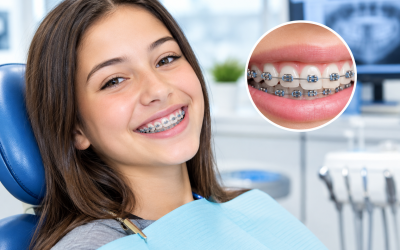 Preparing for Orthodontic Care With Dental Braces in Louisville